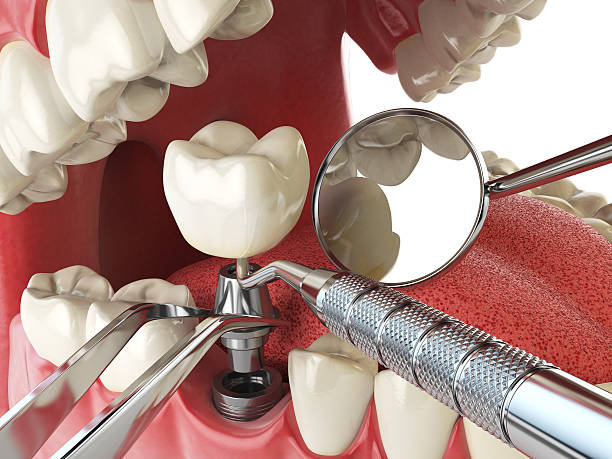 Best Emergency Cosmetic Dentistry in Wingate, NC